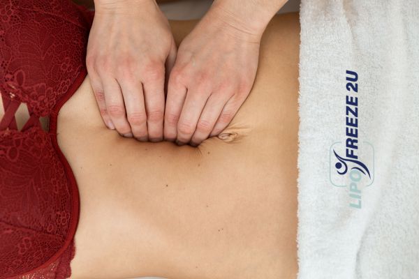 diastasis recti treatment Wellingborough