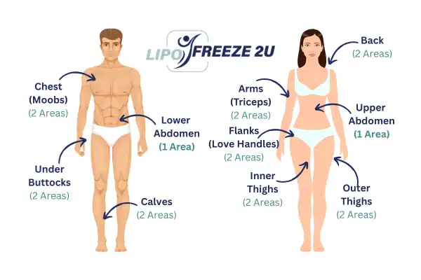 Areas you can have fat freezing treatment Wellingborough