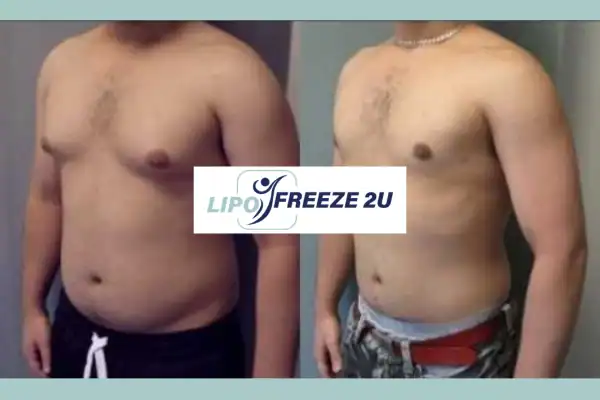 How Long Does It Take to See Results Wellingborough?