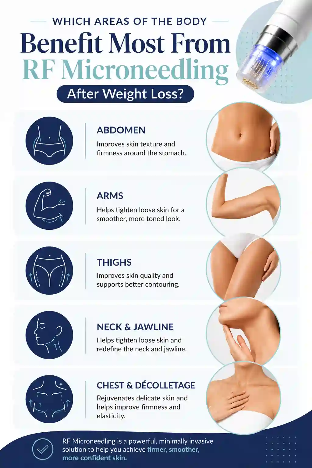 Which Areas of the Body Benefit Most From RF Microneedling After Weight Loss Wellingborough